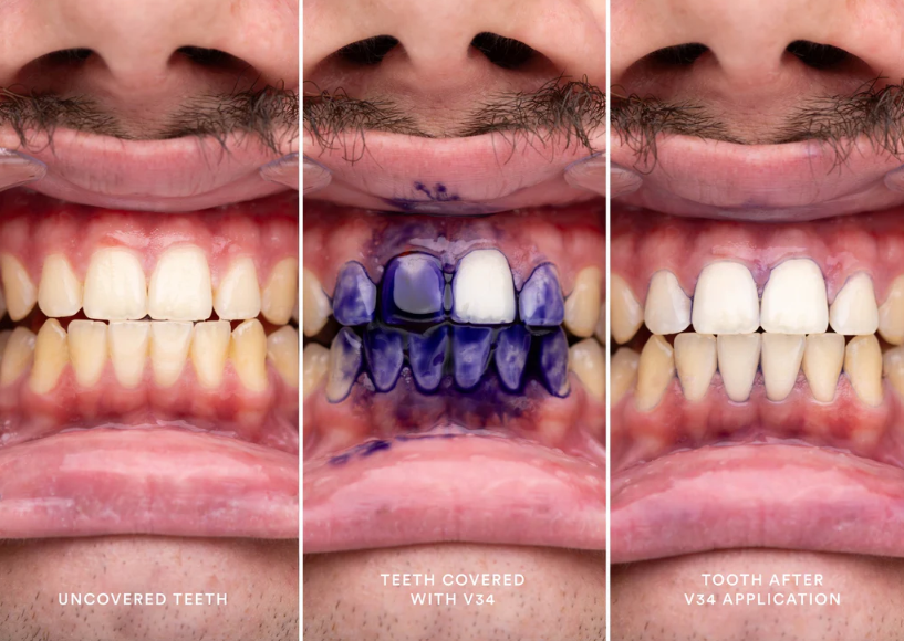 V34 Farbkorrekturserum | Novysmile.